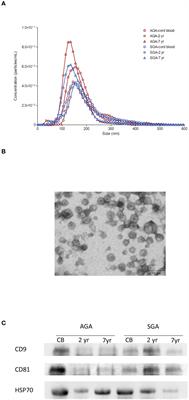Circulating exosomes decrease in size and increase in number between birth and age 7: relations to fetal growth and liver fat